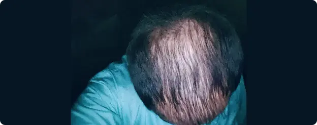 1-2 Months