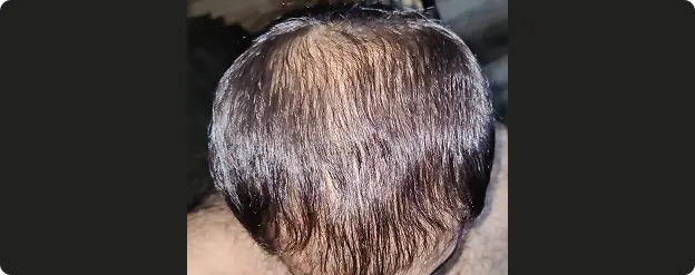 In 6 Months & Beyound