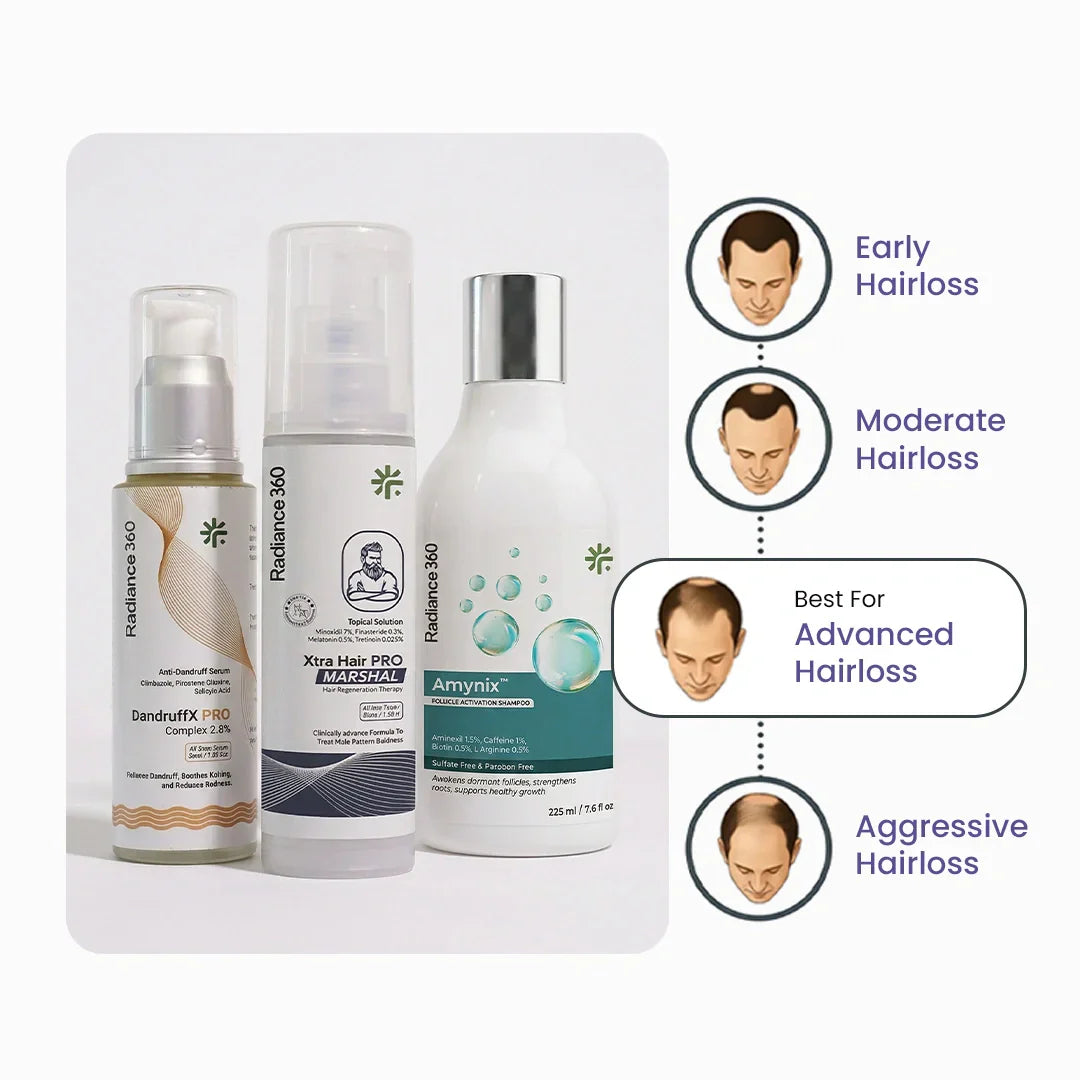 Three hair care products with illustrations of hair loss stages on a white background