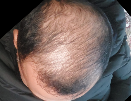 Before - Muhammad Saad