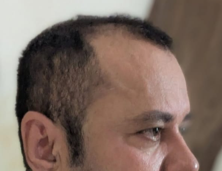 After - Asif Khan