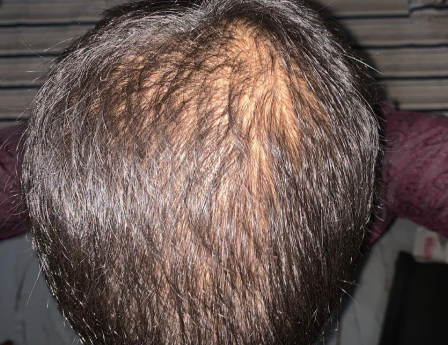 Before - Ubaid Hussain