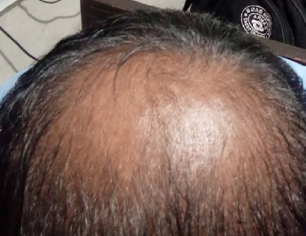 Before - Javed Iqbal