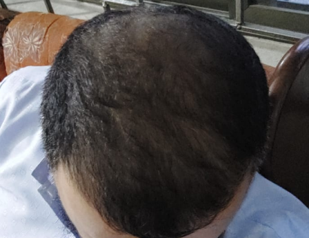 After - Muhammad Saad
