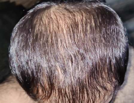 Before - M. Umer Farooq