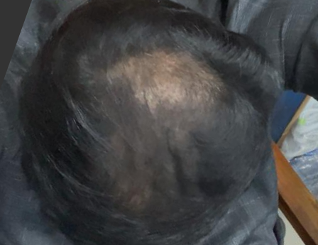 Before - Usama Iqbal
