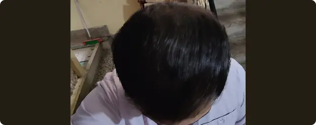 3-6 Months